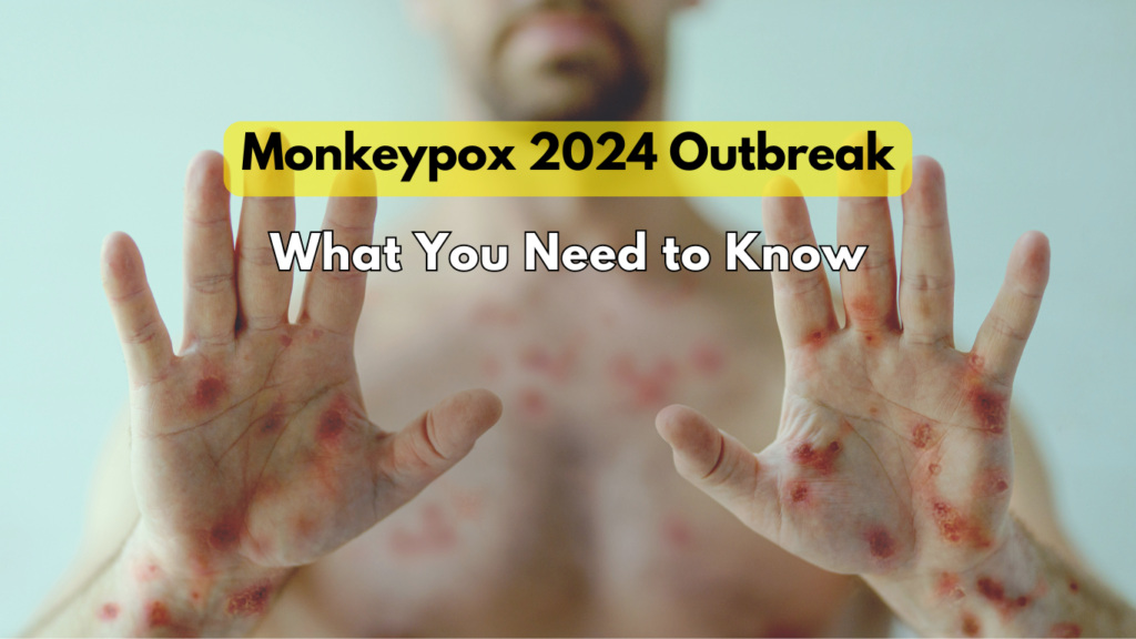 Monkeypox 2024 Outbreak: What You Need to Know